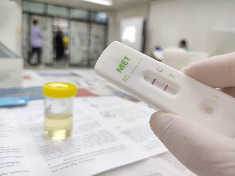drugtest