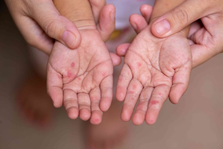 hand1